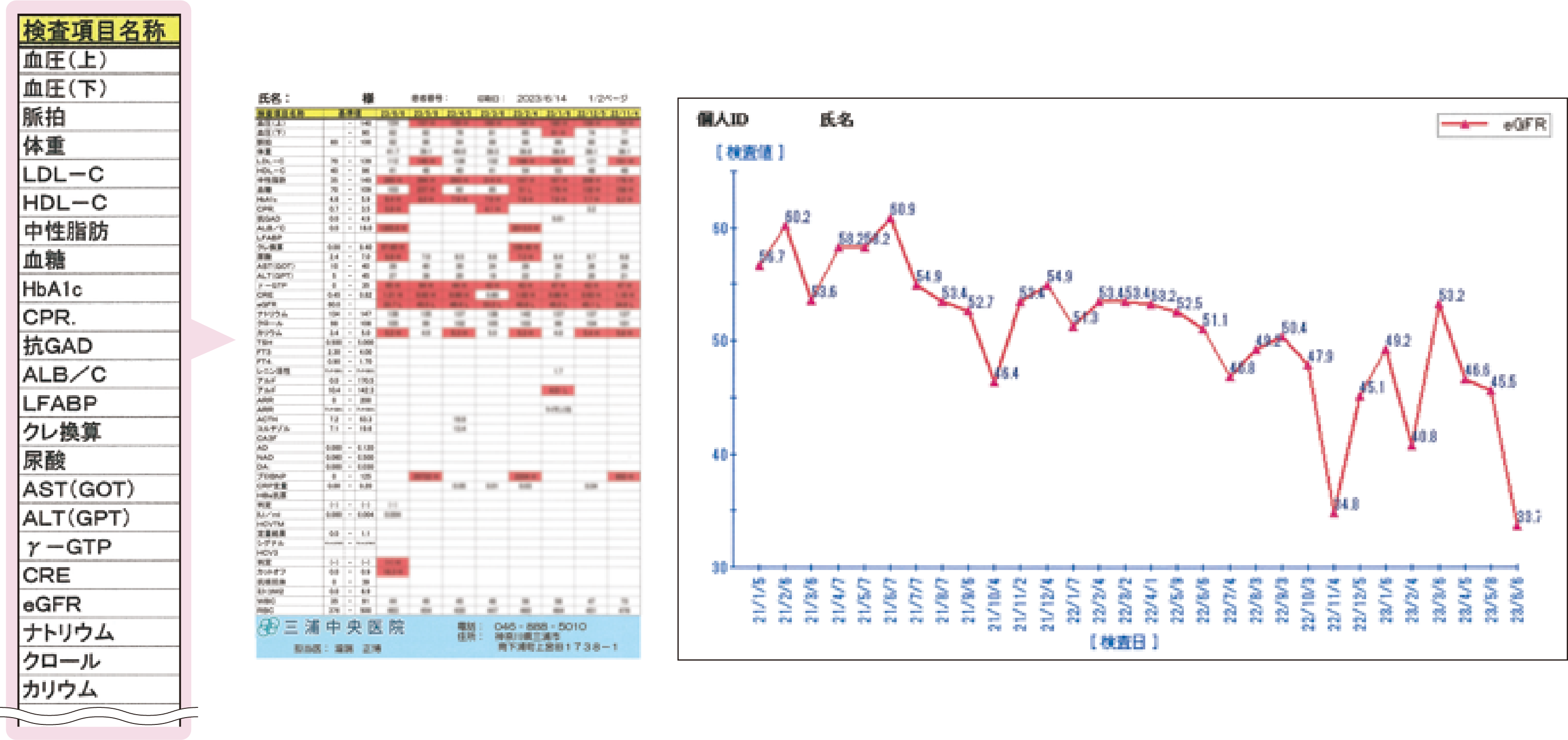 プリントアウトした検査結果一覧表と主な検査項目の抜粋（左図）及びeGFRの推移のグラフ（右図）
