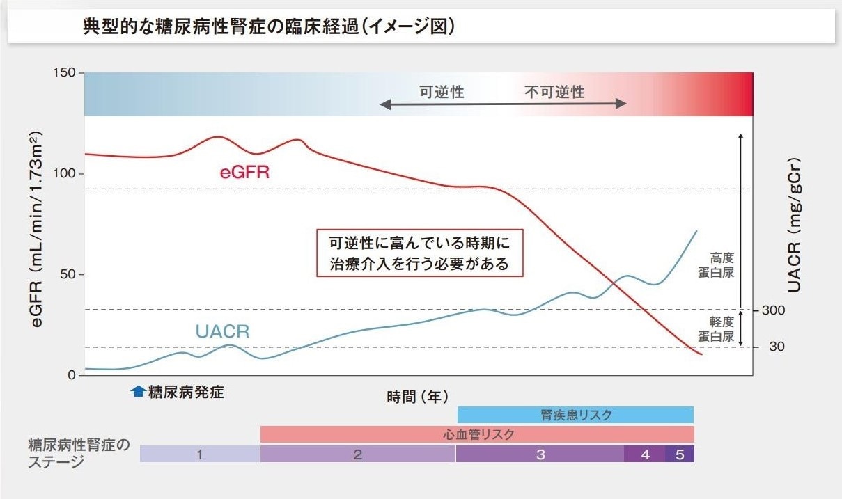 典型的な糖尿病性腎症の臨床経過（イメージ図）