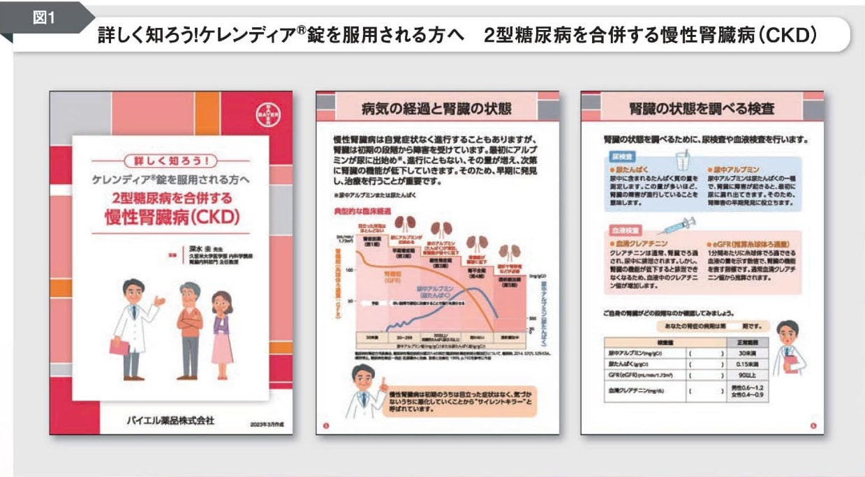 詳しく知ろう!ケレンディアR錠を服用される方へ 2型糖尿病を合併する慢性腎臓病(CKD) 